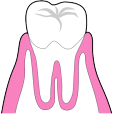 歯周病　健康な状態
