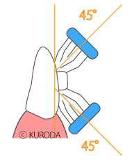 ブラケット周りの磨き方