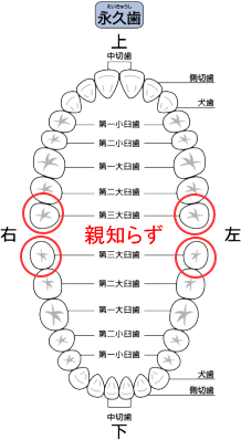 親知らず